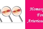Homeopathic medicine for Arteriosclerosis