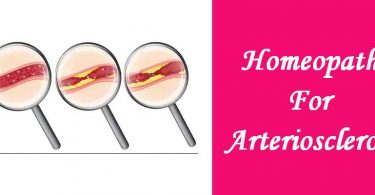 Homeopathic medicine for Arteriosclerosis