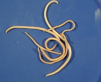 Roundworms - parasites in human intestines