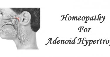 Homeopathic Medicine for Adenoid Hypertrophy