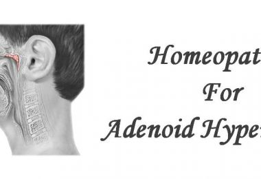 Homeopathic Medicine for Adenoid Hypertrophy