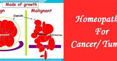 Homeopathic medicine for Cancer