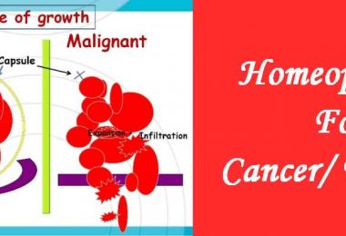 Homeopathic medicine for Cancer