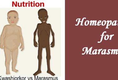 Homeopathic medicine for Marasmus