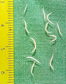 Pinworms - parasites in human stomach and intestines