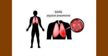 Severe Acute Respiratory Syndrome (SARS) / Atypical Pneumonia