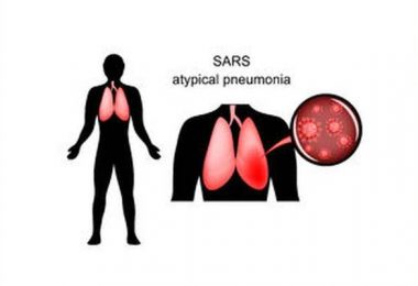 Severe Acute Respiratory Syndrome (SARS) / Atypical Pneumonia