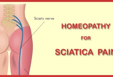 sciatica pain homeopathy