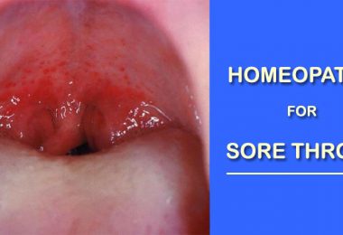 sore throat homeopathy