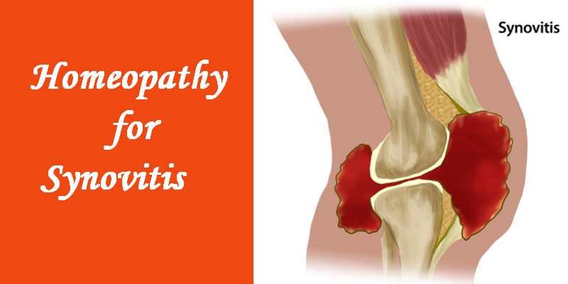 Homeopathic medicine for Synovitis