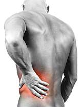 Homeopathy Treatment and cure of back pain.