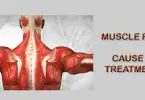 muscle pain homeopathy treatment