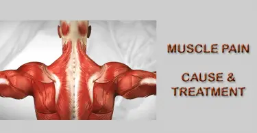 muscle pain homeopathy treatment