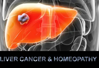liver cancer homeopathy
