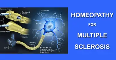 multiple sclerosis homeopat
