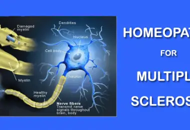 multiple sclerosis homeopat