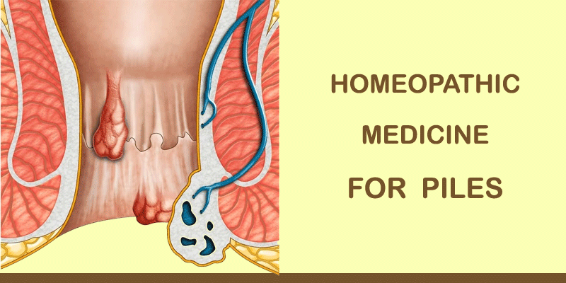 homeopathic medicine for piles treatment