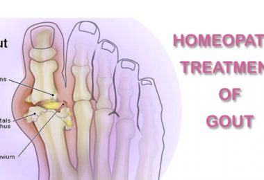 homeopathic remedies for gout pain