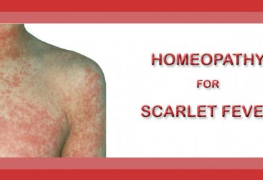 scarlet fever homeopathy