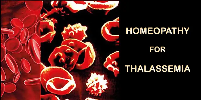 thalassemia homeopathy medi