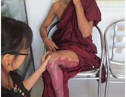 Monk burnt in Burma