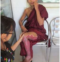 Monk burnt in Burma
