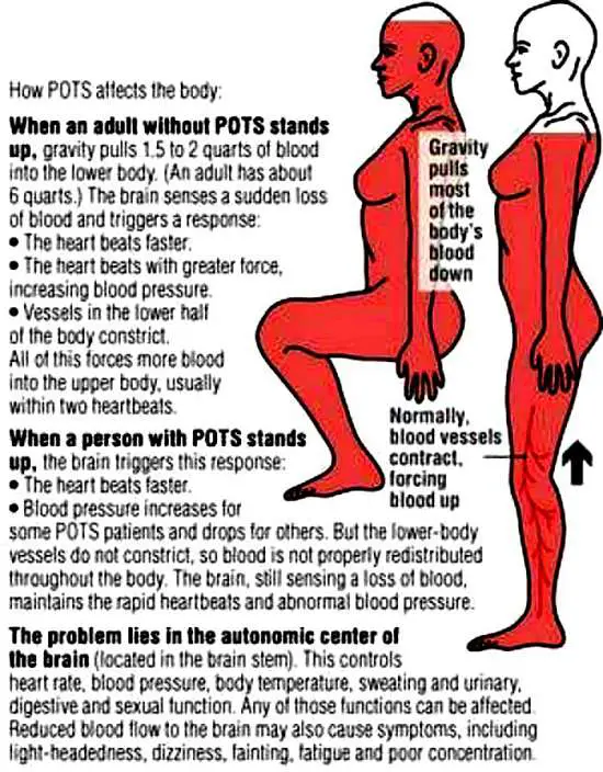 POTS - How POTS affects the body