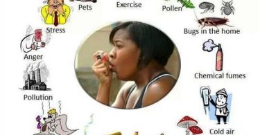 A Case of Asthma jan