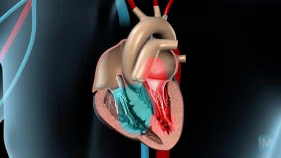 heart pain angina pectoris