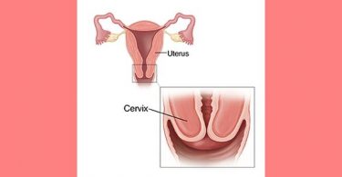 cross section of uterus with inset showing closeup of cervix