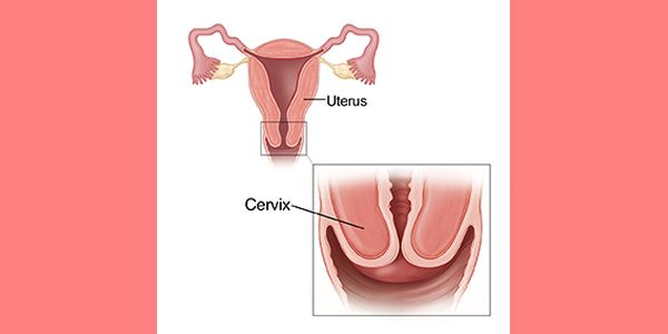 cross section of uterus with inset showing closeup of cervix