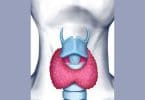 Postpartum thyroiditis Picture