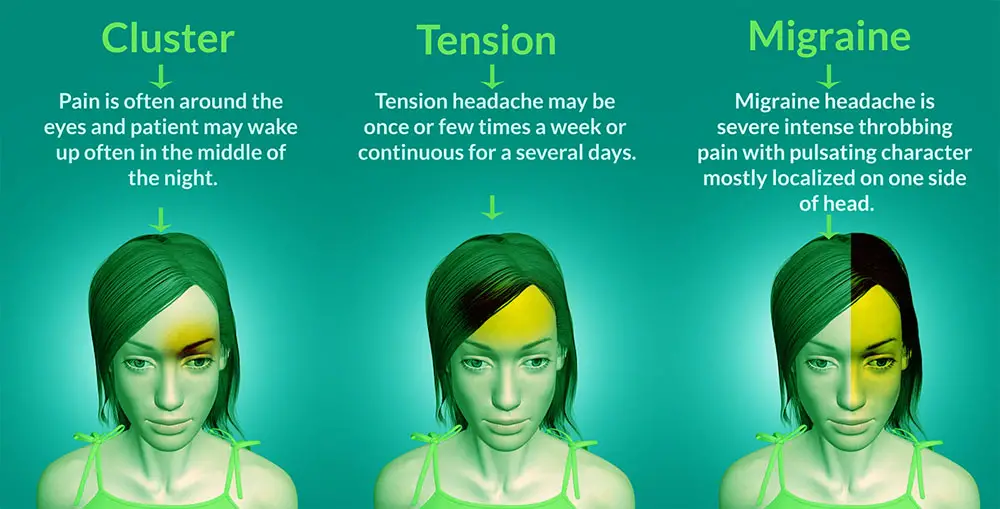 types of headache