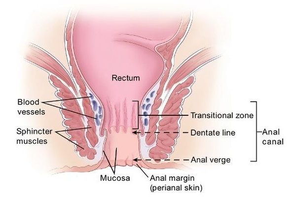 hemorrhoids treatment with homeopathic remedies