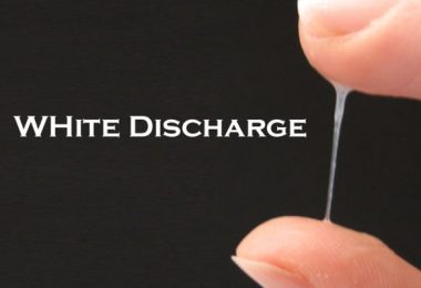 White Discharge