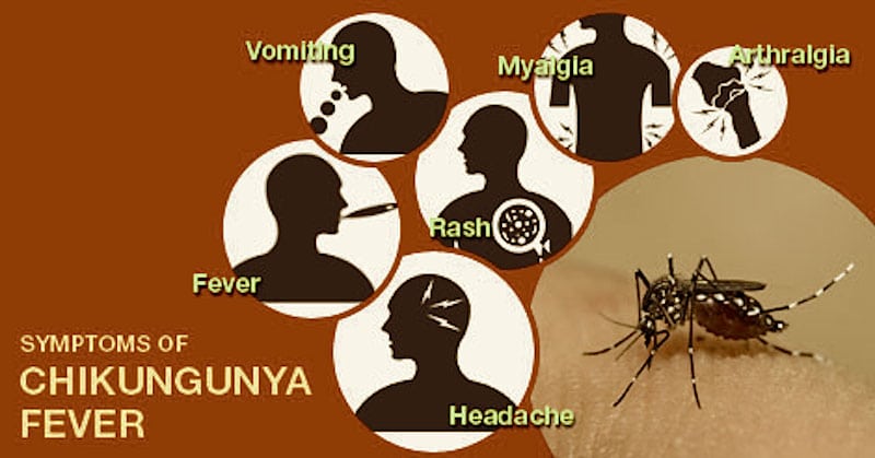 chikungunya fever