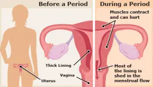 menstrualCramps