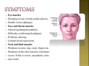 symptoms of myasthenia gravis. homeopathic cure for myasthenia gravis
