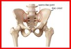 Sclerosis of Unilateral Sacroiliac Joint in a Woman of 27