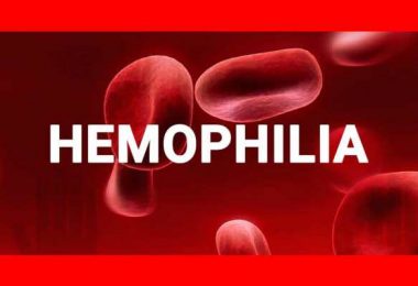 Research Studies on Haemophilia with Homeopathic Medicines Cometh the Hour, Cometh the Man